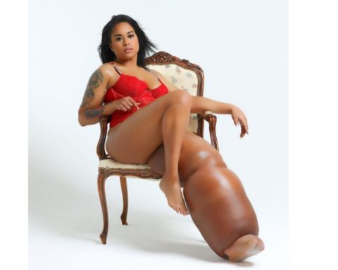 Model with a leg that weighs more than 45 kilos breaks beauty stereotypes: this is her story