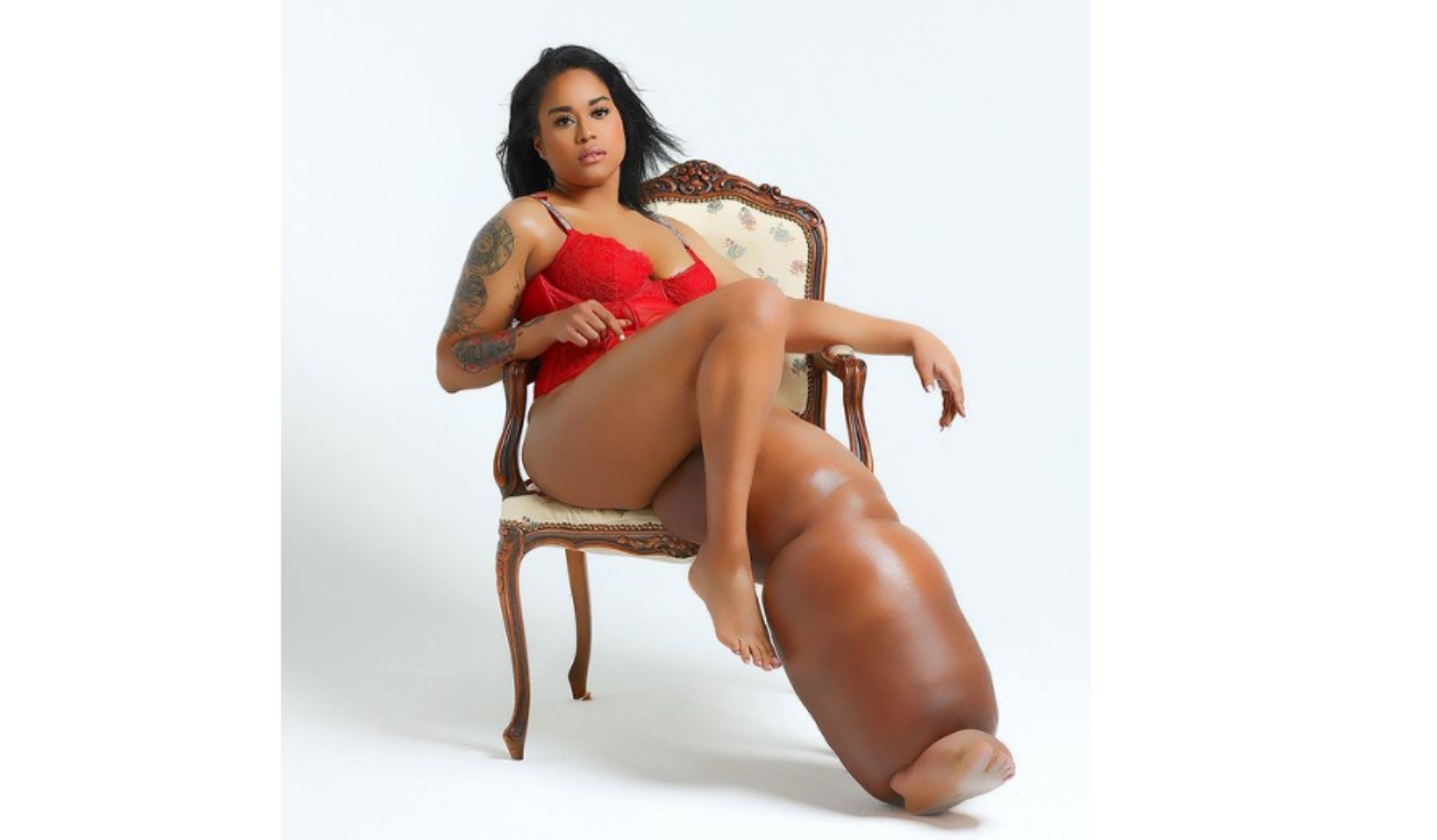 Model with a leg that weighs more than 45 kilos breaks beauty stereotypes: this is her story