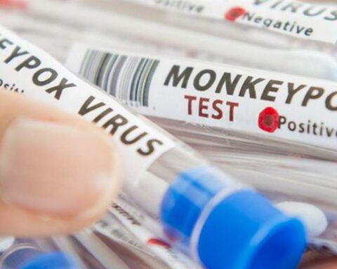 Monkeypox continues to add new cases in Santa Cruz