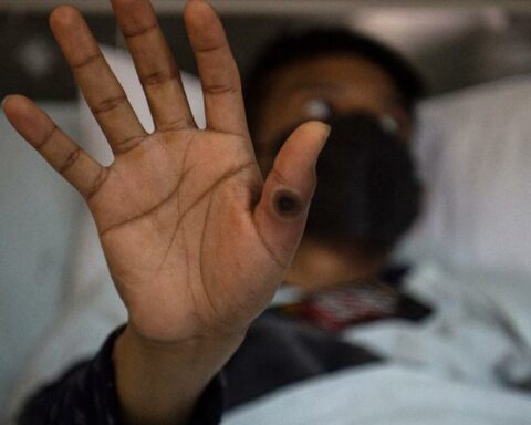 Monkeypox in Peru: infections rise to 2054, reports the Minsa