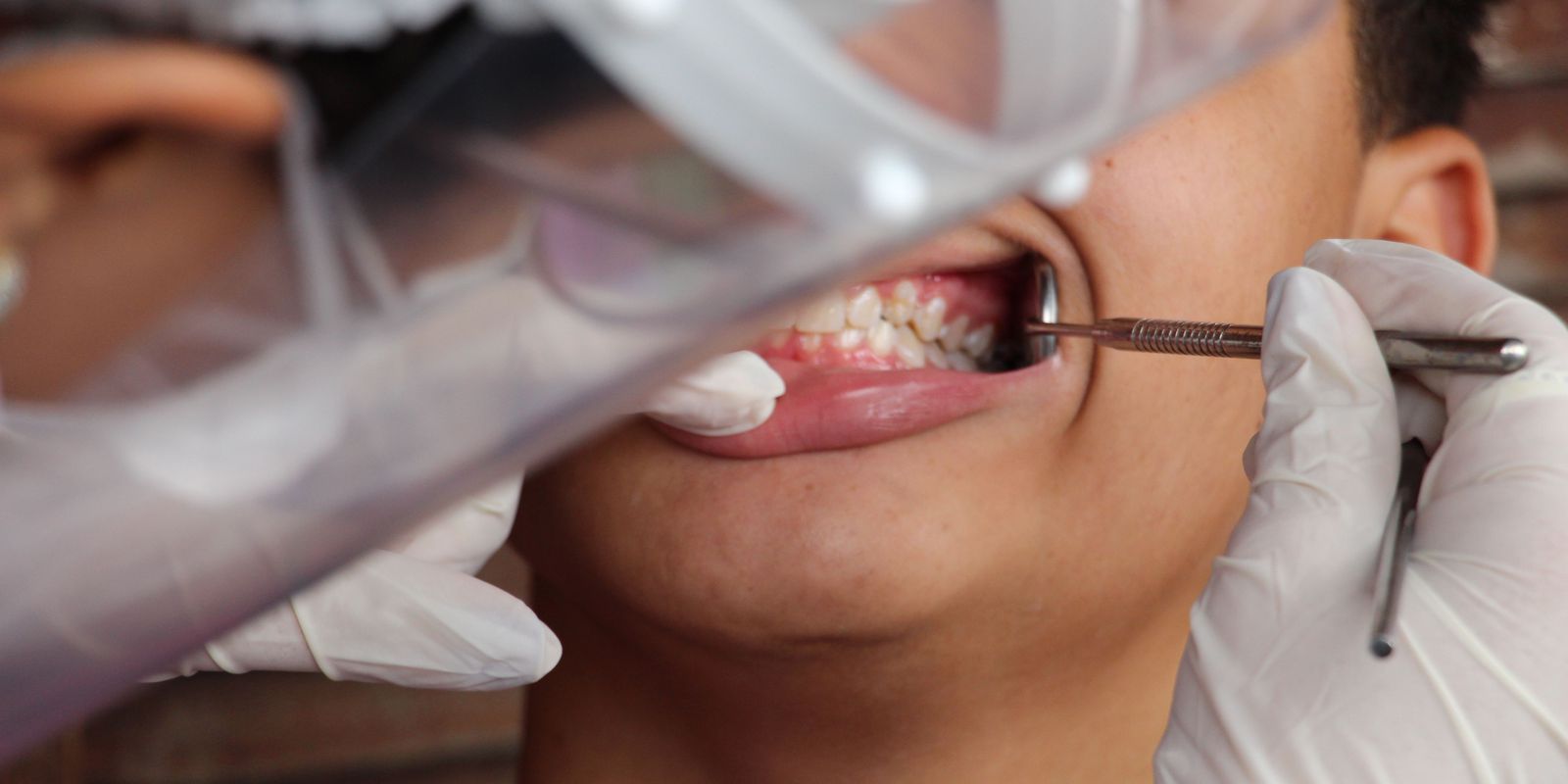 Oral health data collection is extended until September 30