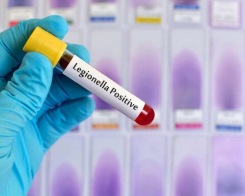 Pneumonia due to Legionella: the governor of Tucumán maintained that the situation has been "identified"