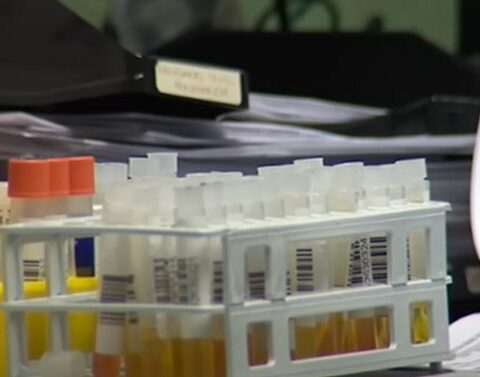 viruela del mono, Cuba, MINSAP