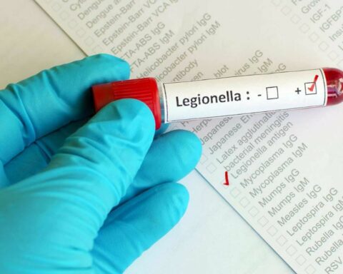 The WHO spoke about the outbreak of legionella in Tucumán and issued a series of recommendations
