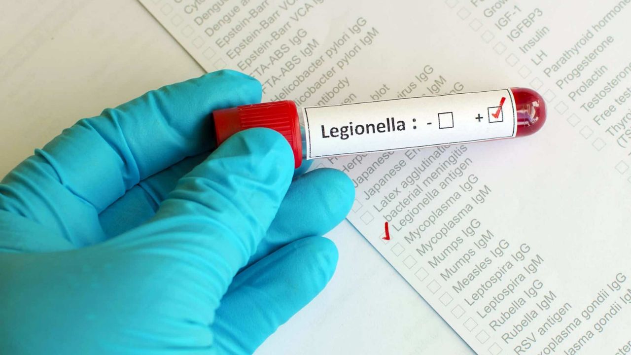 The WHO spoke about the outbreak of legionella in Tucumán and issued a series of recommendations