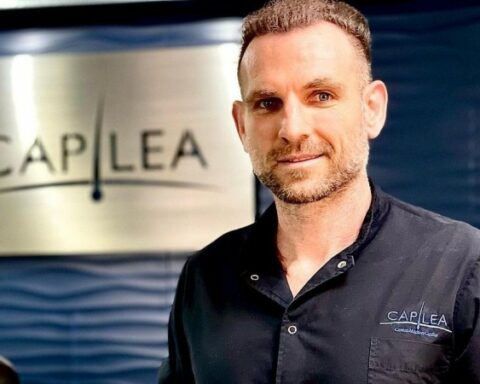 Bruno Szyferman confirms that Lacalle Pou had a hair intervention, but says that he did not do it