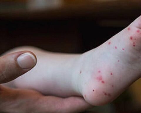 virus, niños, Las Tunas