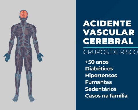 Number of Brazilians killed by stroke grows