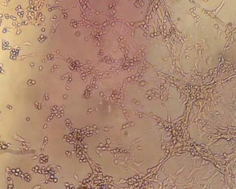 Rio records second death of monkeypox infected