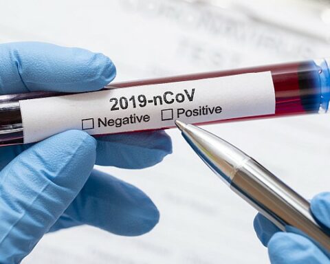 To date there are six people hospitalized for COVID in the department