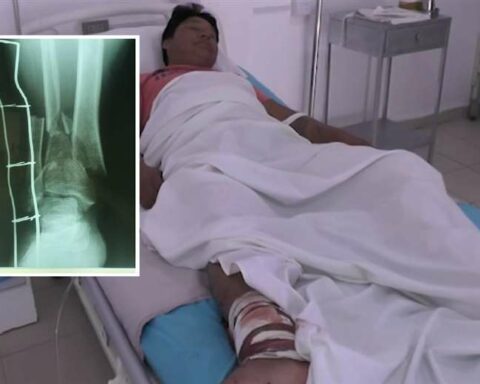 Trucker is robbed and attacked with machetes by three people