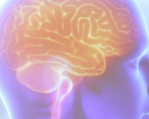 World Stroke Day: alert campaign for signs and rapid diagnosis