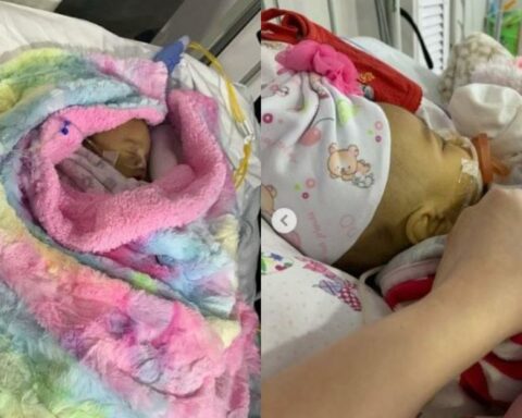 4-month-old baby with Ultra-Short Bowel Syndrome needs help for his treatment
