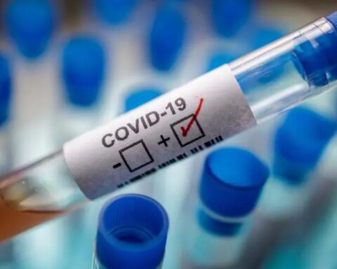 En RD hay 441 casos activos de covid-19