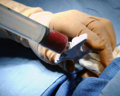 Record of 91 bone marrow donations in Argentina