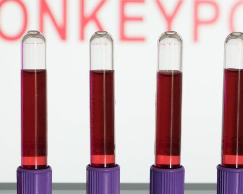 Rio de Janeiro records two more monkeypox deaths