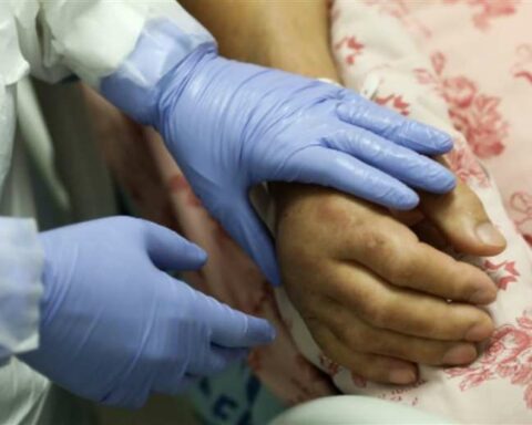 Sick with monkeypox can spread before showing symptoms