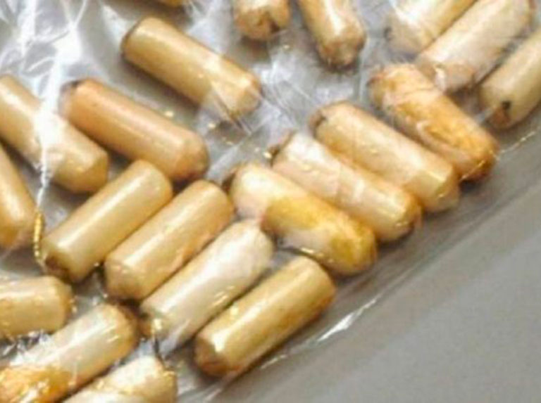 They arrested three women with 183 cocaine finger cots