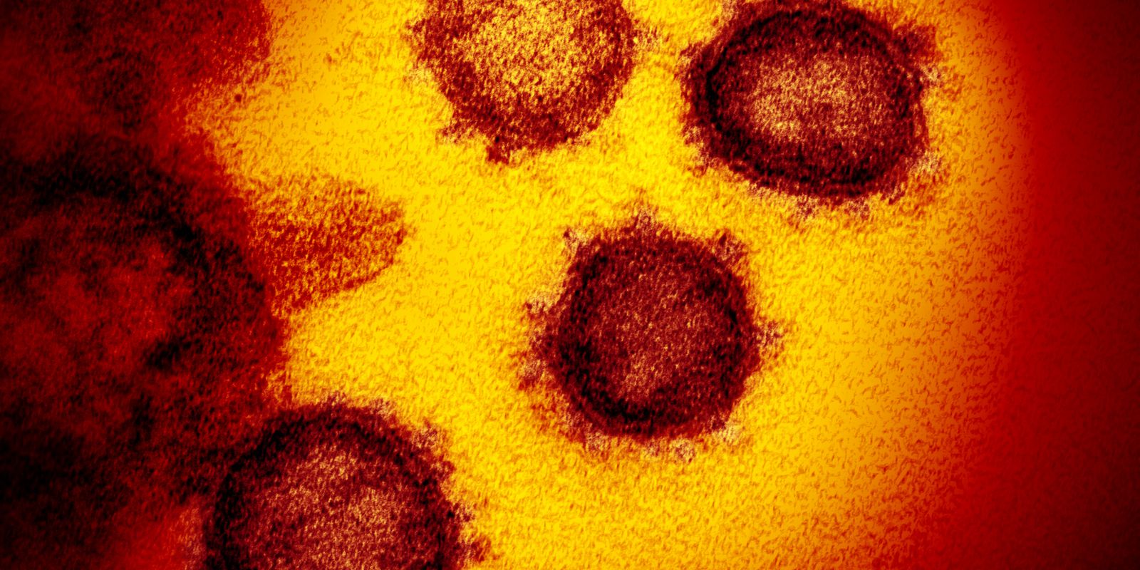 Two new strains of coronavirus identified in Brazil