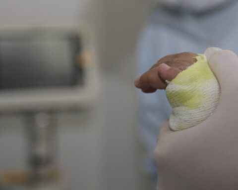 5-year-old boy is the new victim of gunpowder in Valle del Cauca