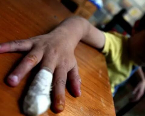 Gunpowder burns increased to 15 during the first two days of December