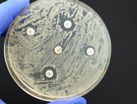 MSP warns of increased cases of a new bacterium