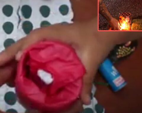 No va una semana de diciembre y ya van 4 casos de quemados con pólvora en el Valle del Cauca: en Colombia van 21