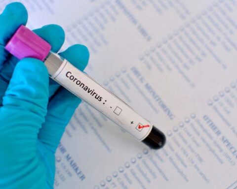 Notifican 326 casos nuevos de covid-19 en últimas 24 horas