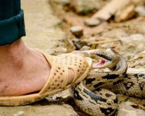 What to do in case of being bitten by a snake?