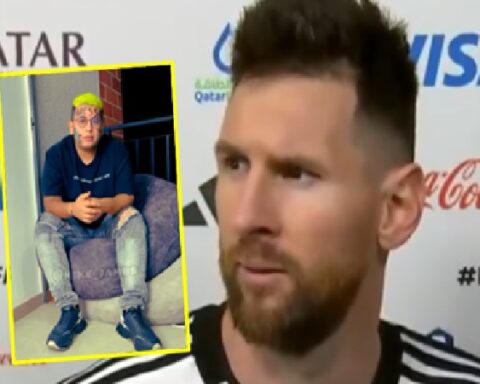 Young Colombian who tattooed "Messi" on his face is sorry, is the mark permanent?
