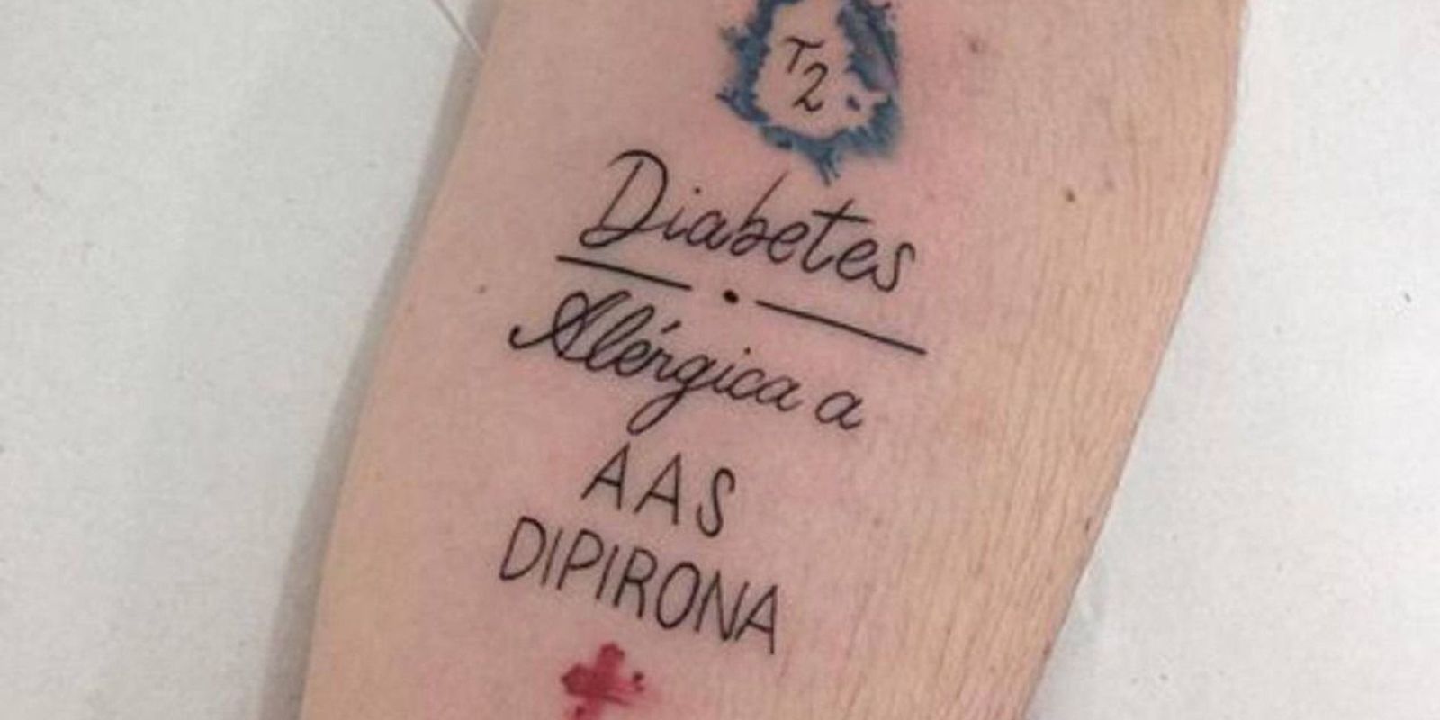 Event will donate safety tattoos to people with chronic illnesses