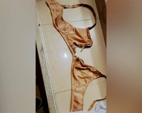 A man throws acid on his wife and causes serious burns