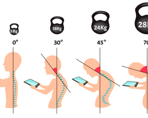 What is the “Text Neck” Syndrome and what are the health consequences?