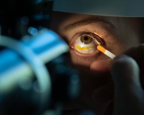 Glaucoma, second common cause of blindness