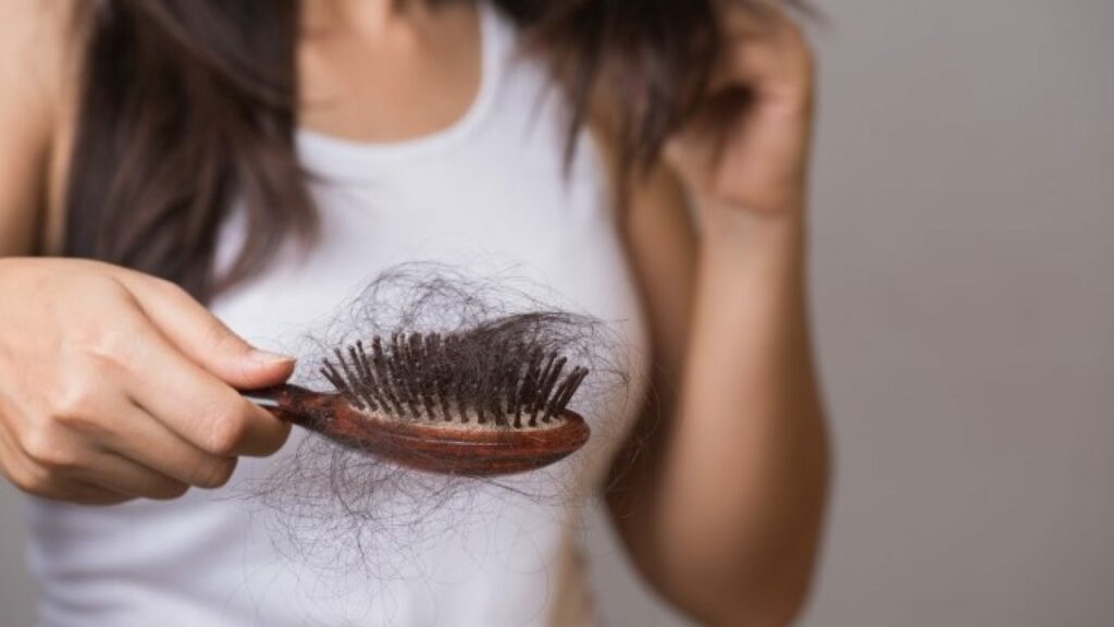 Post chikungunya hair loss is common, but reversible