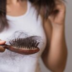 Post chikungunya hair loss is common, but reversible