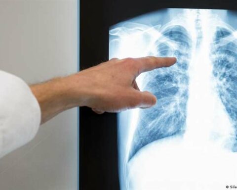 WHO warns of an increase in tuberculosis cases in Europe