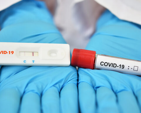 Nearly 150 new positive cases of COVID-19 reported