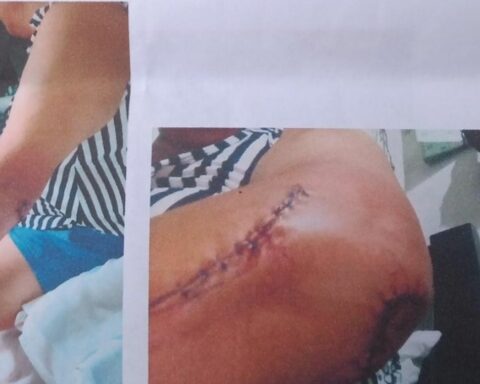 The drama of a woman victim of a brutal attack by an InDriver driver in Bucaramanga