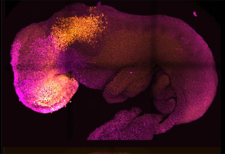 Gastrulation, the mysterious stage of pregnancy that some consider "the most important moment of our lives"