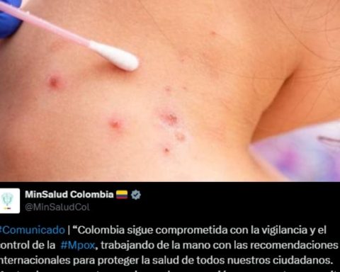 "Vaccines are not ruled out": Ministry of Health in response to 109 cases of monkeypox in Colombia