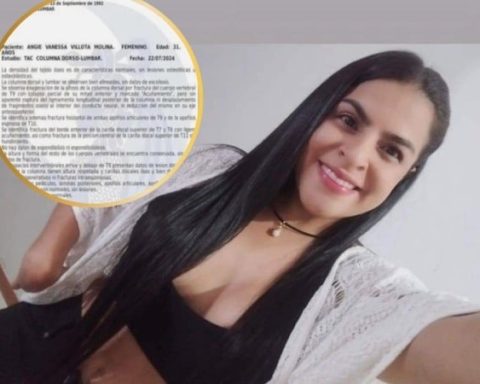 Colombian woman had an accident in Mexico and they ask for help for a surgery to give her hope back