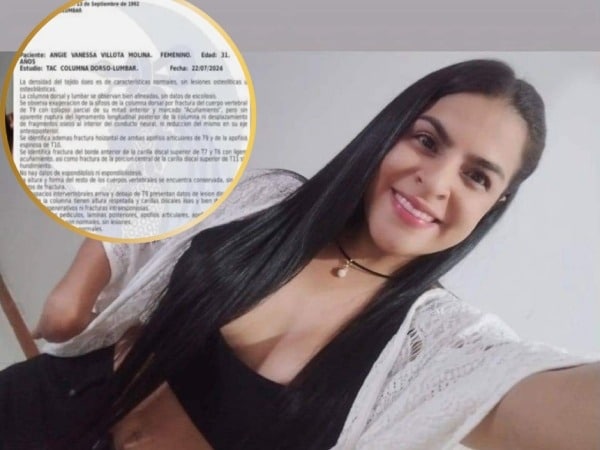 Colombian woman had an accident in Mexico and they ask for help for a surgery to give her hope back