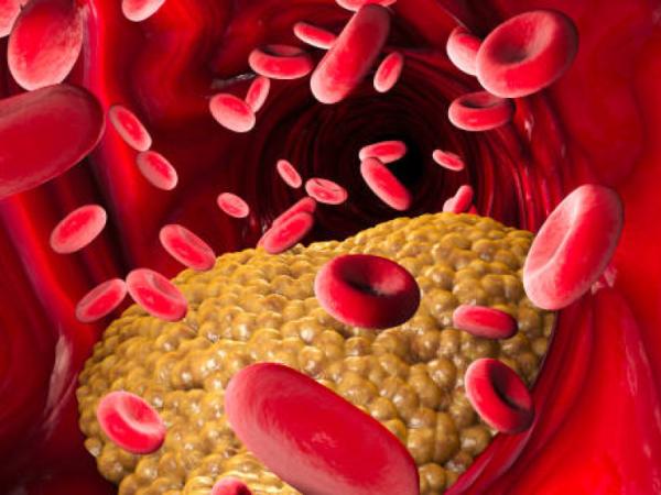 What is a healthy triglyceride level that everyone should have?