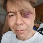 Designer died after being beaten