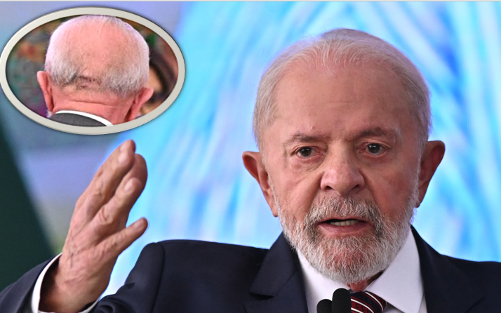 Lula remains stable after the blow to the back of the head and will repeat medical examinations in a week