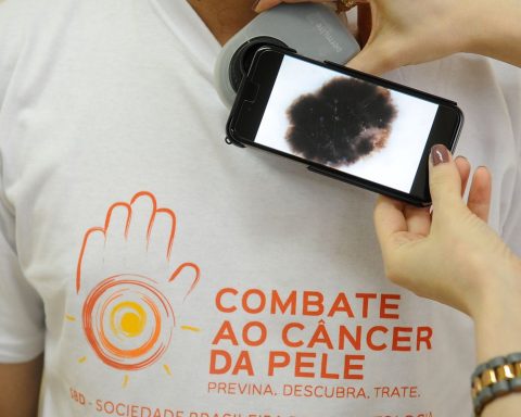 Mutirão serves the population today, on the day to combat skin cancer