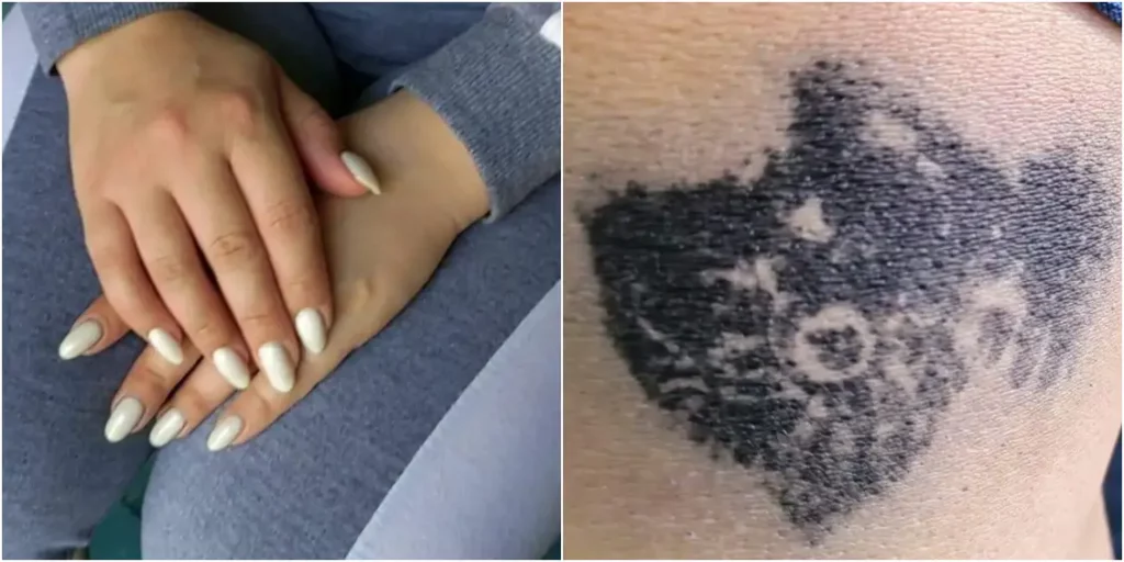 La joven cubana secuestrada en Tapachula / El tatuaje temporal con el que fue marcada