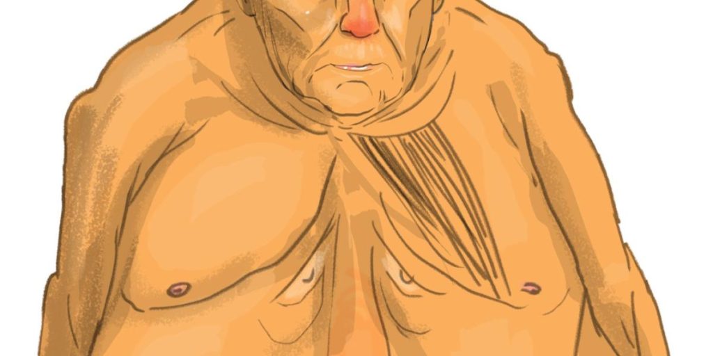 Naked Trump