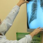 Brazil is against the WHO goal for the extinction of tuberculosis